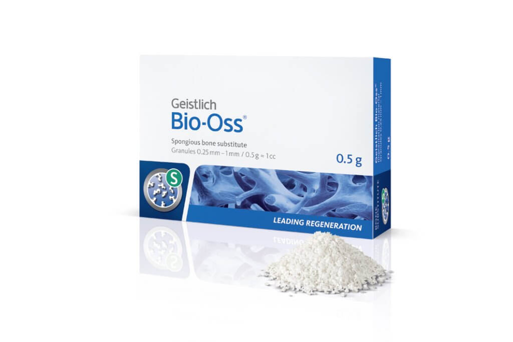 BioOss骨粉,目前全球被研究舉證最多的骨粉,為異體骨