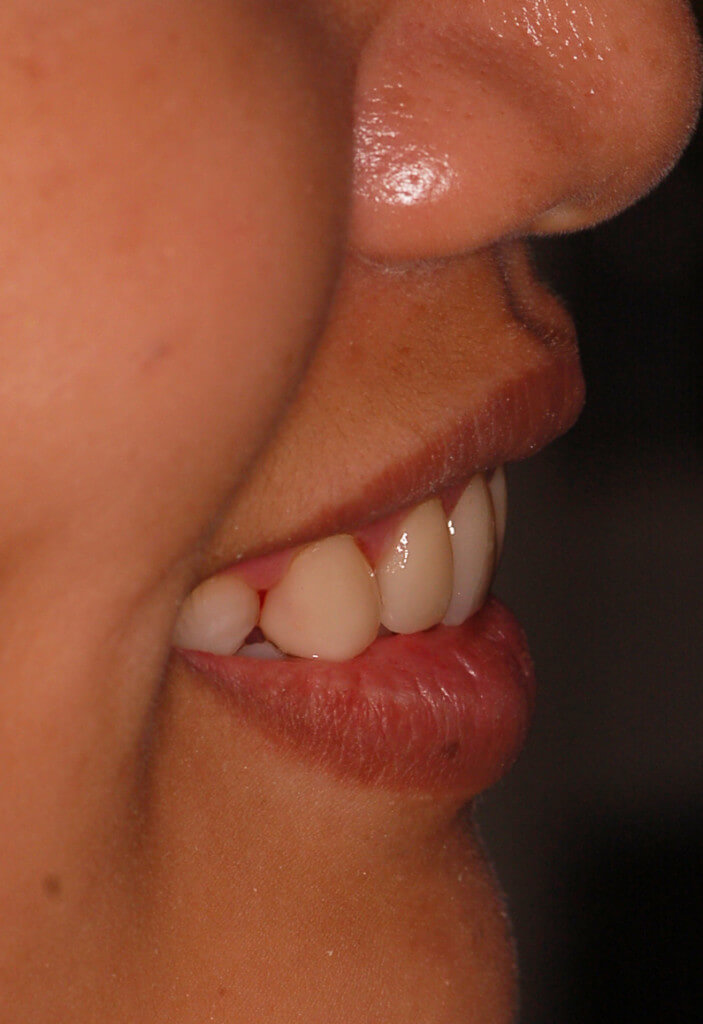 right view 2