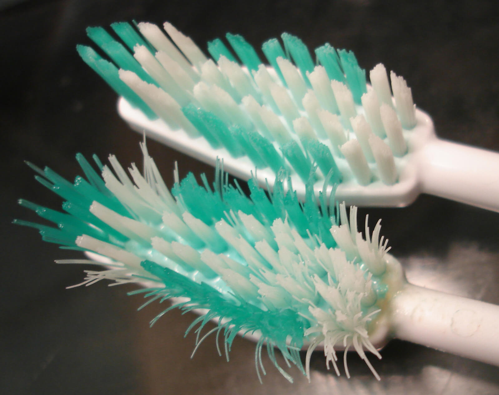 牙周病的治療方式介紹