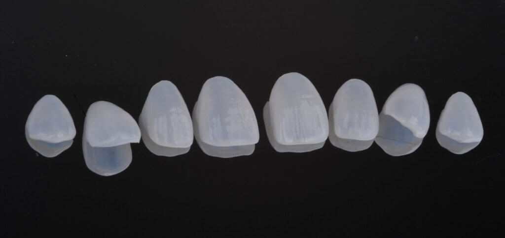 全鋯冠與全瓷冠的不同