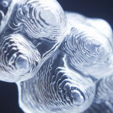 隱形矯正品牌怎麼選? 談談隱適美的四大優勢