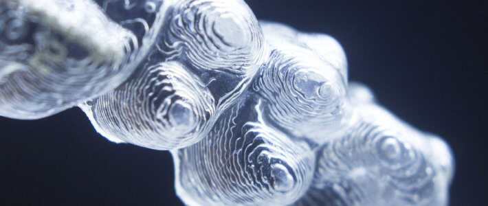 隱形矯正品牌怎麼選? 談談隱適美的四大優勢 隱形矯正品牌怎麼選? 談談隱適美的四大優勢