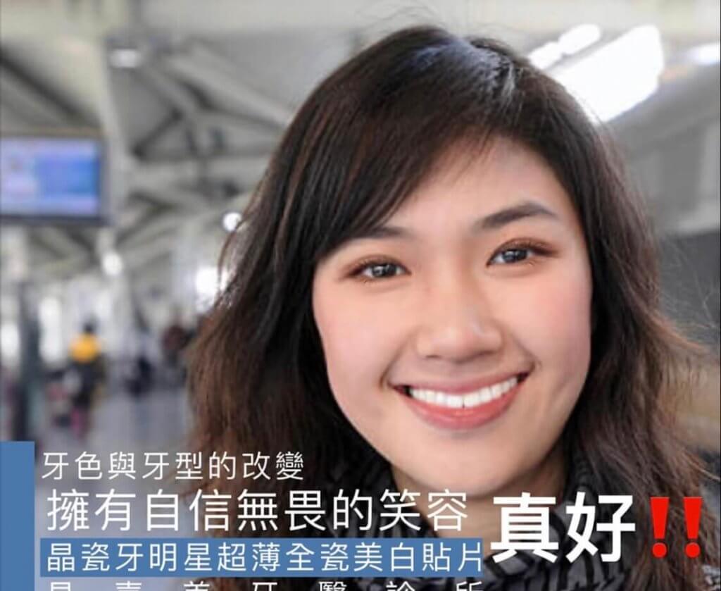 微笑設計