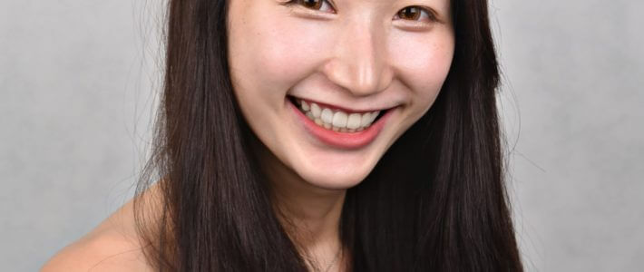 Amanda|全瓷冠與陶瓷貼片 Amanda|全瓷冠與陶瓷貼片