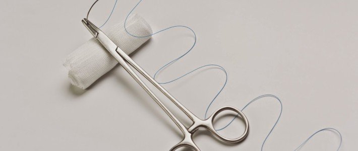 人工植牙好不好? 常見問題總整理 人工植牙好不好? 常見問題總整理