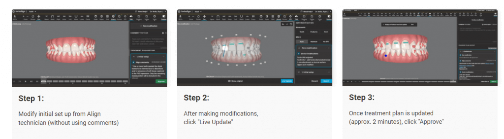 隱適美clincheck流程圖